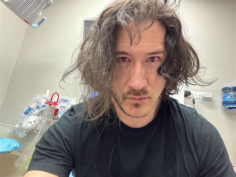 markiplier in hospital|what happened to markiplier eyes.